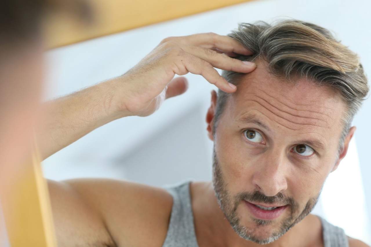 Empresas especializadas como My Special Hair: ¿Son las prótesis capilares a medida el futuro?