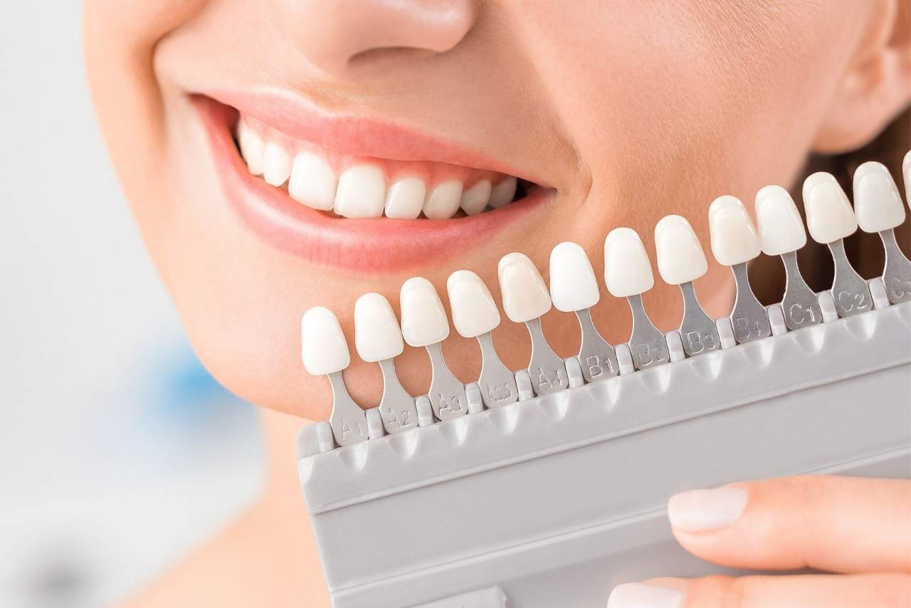 Los implantes dentales: Clínica dental Helident en Sevilla