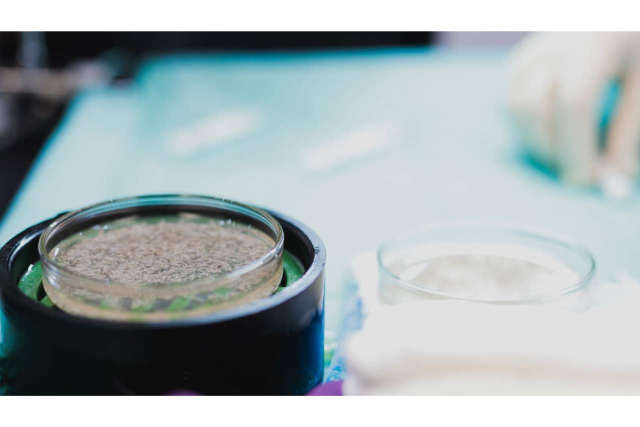 Adcure Clinic, número uno en la técnica de implantación DHI