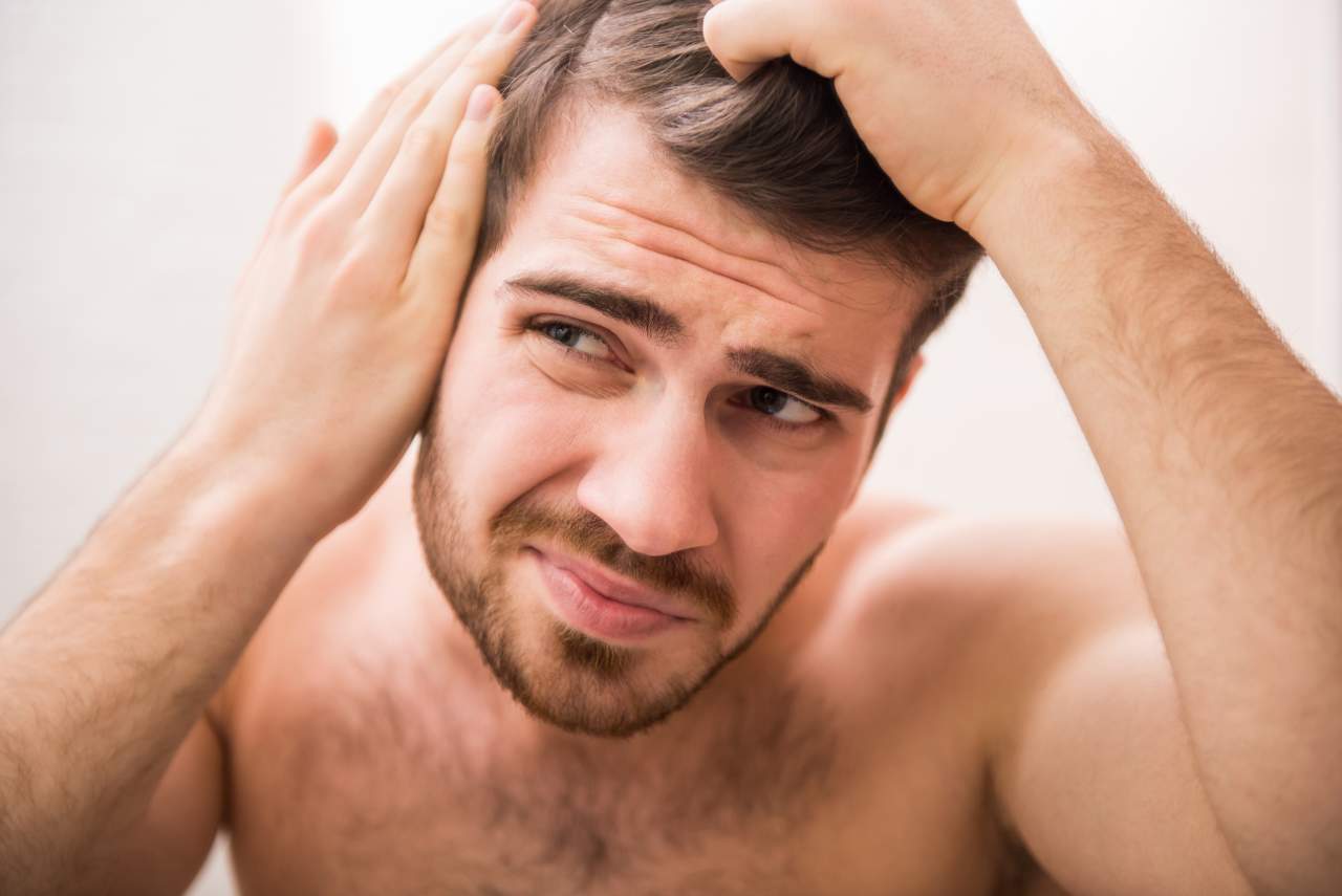 Un 42% de hombres en España son calvos, ¿cómo retrasar ese efecto? Método DHI por Dr. Bern Barbehito