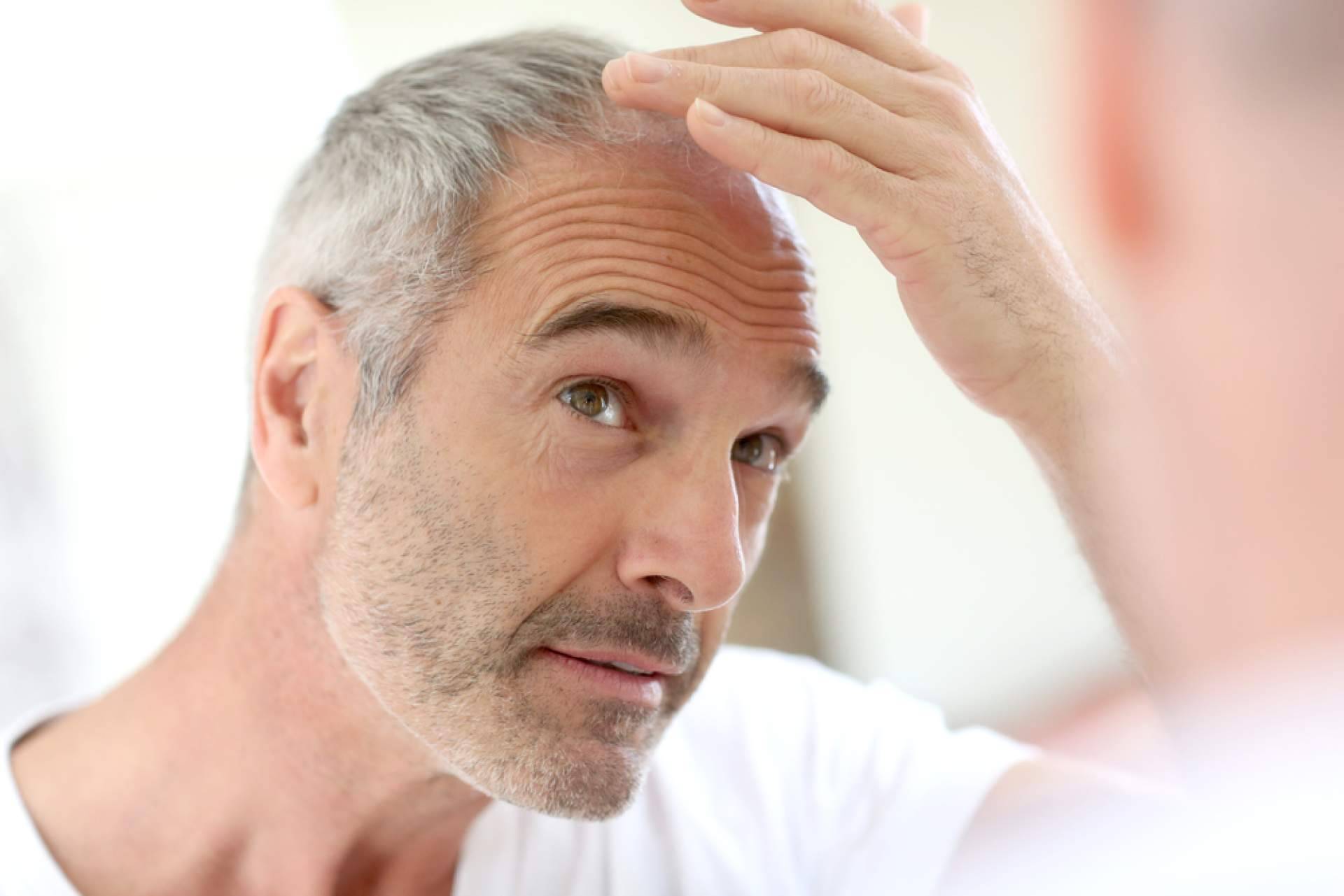 HairFluencer presenta una selección de sus mejores productos para el cuidado post trasplante capilar